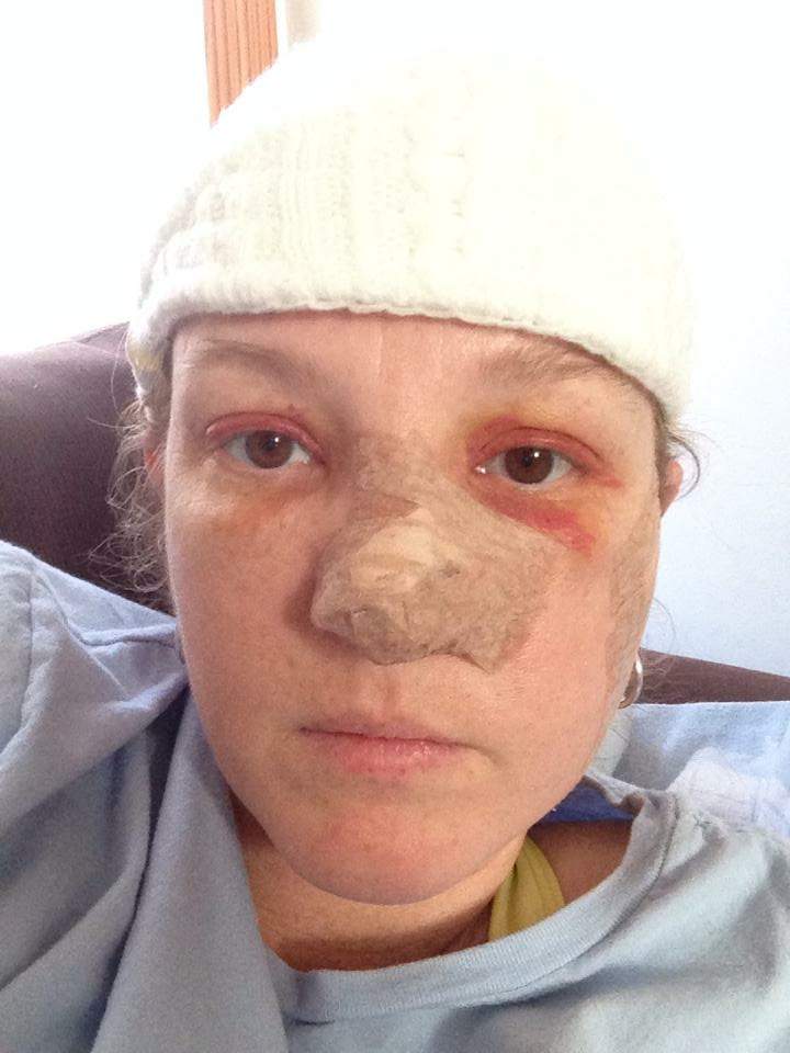 Woman opens up about surviving 86 skin-cancer surgeries: ‘I don’t have quit in me’ - image