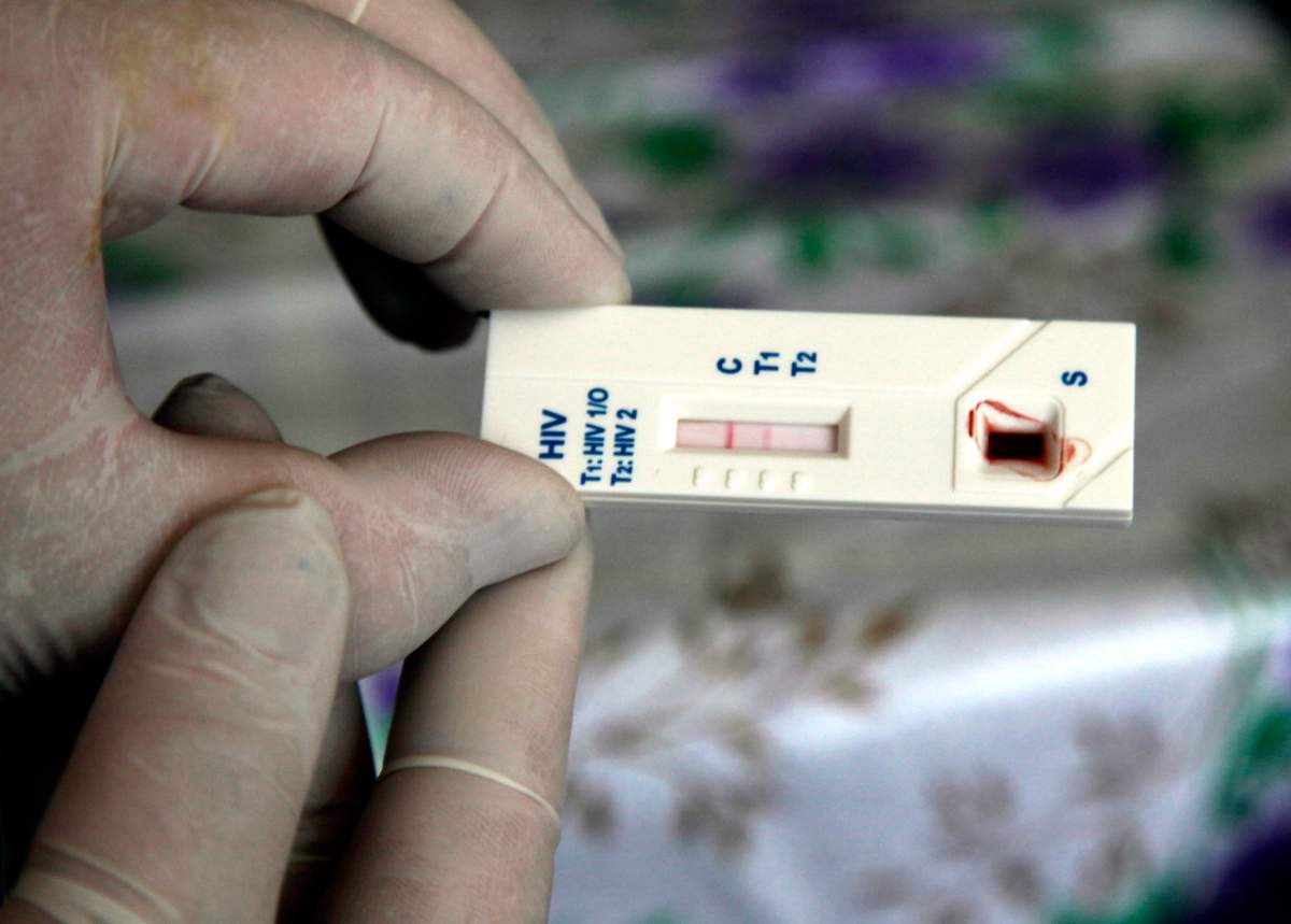 A HIV/AIDS rapid blood test shows the two red strips of a positive result. A national 'HIV testing day' is set for June 27.