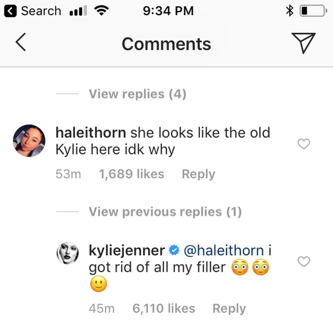 Kylie Jenner says she’s removed all fillers from her lips - image
