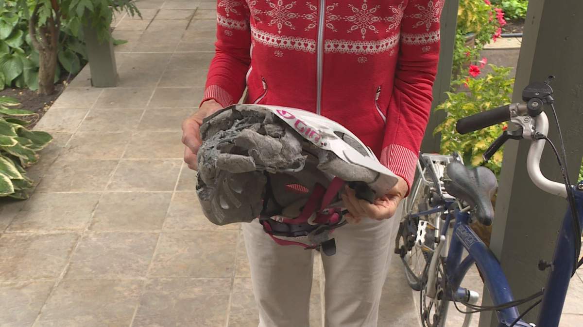 A closer look at the damage done to Wilmot’s bike helmet.