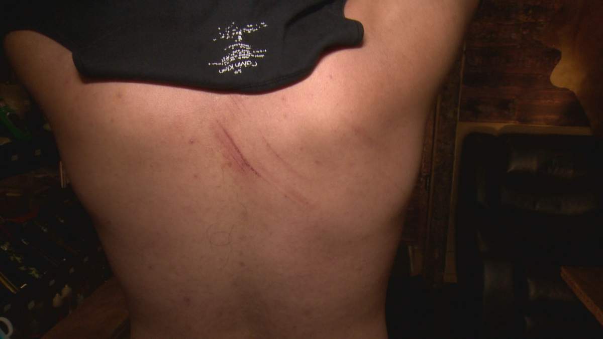 Apart from some sore muscles and a scratch on his back, Belal Ajami survived the fall virtually uninjured.