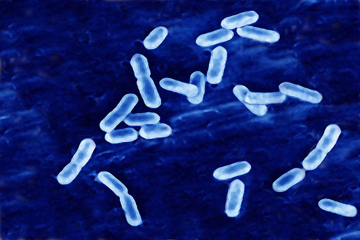 Listeria Monocytogenes causes Listeria infection.
