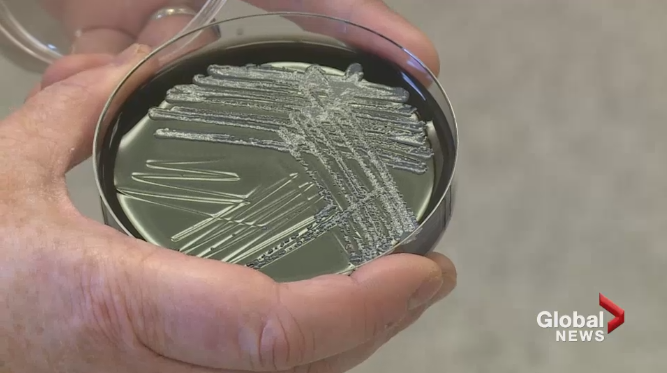 Legionella bacteria is seen in a petri dish in this undated photo. 