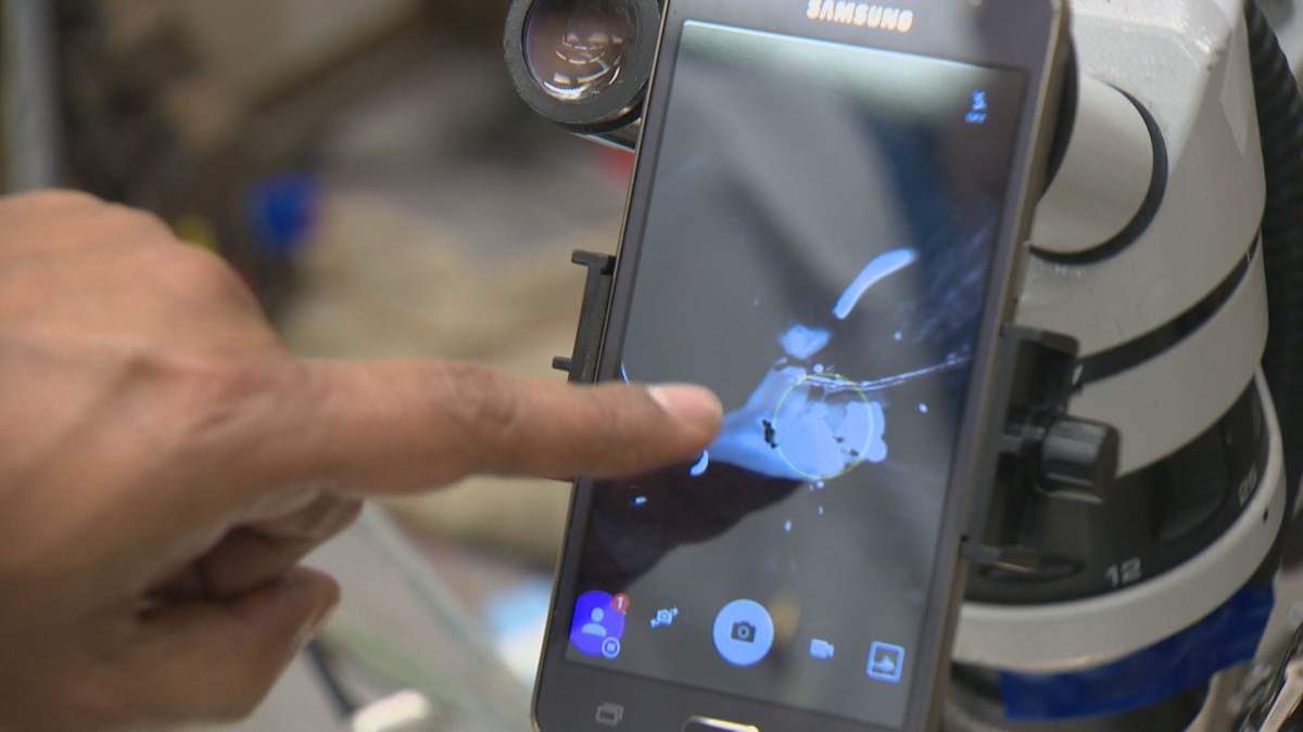 An out-of-the-box approach discovered by researchers at the University of Calgary may be able to eliminate allergen-induced asthma attacks. 
