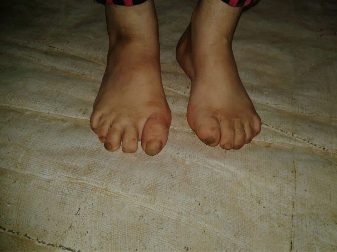 Azari Darwish’s feet.