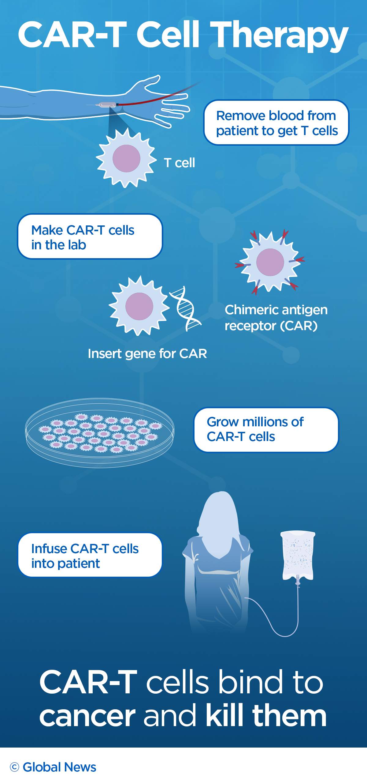 Immune system fights cancer: How one boy beat leukemia with new treatment - image