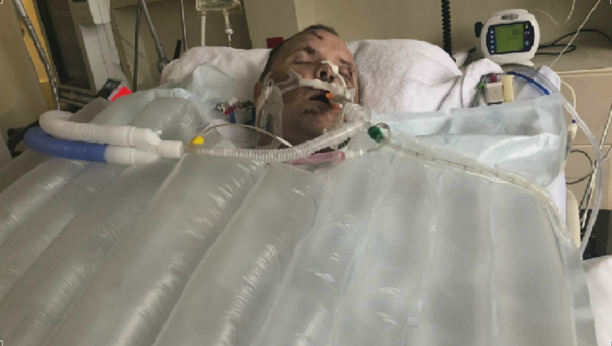 Jonathan Sedman’s injuries were so severe that his sister Jennifer said she was worried he wouldn’t be the same person when he woke up.