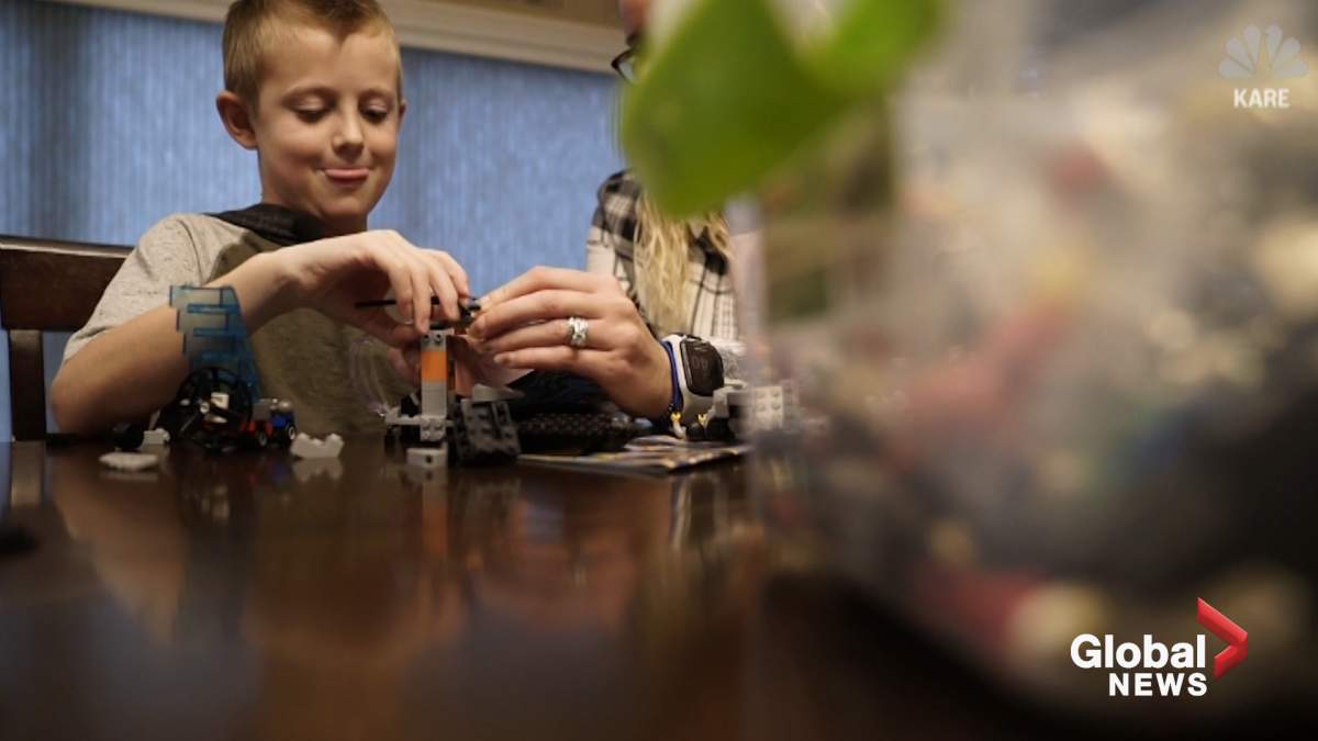 6 kids in Minnesota develop rare ‘polio-like’ illness and officials don’t know why - image