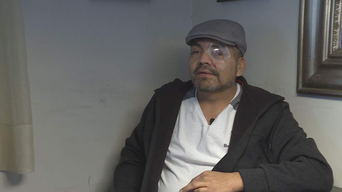 Doug Thomas was attacked while attempting to defend a homeless man from an assault. 