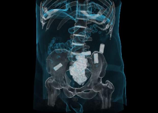 Drugs inside someone’s body.