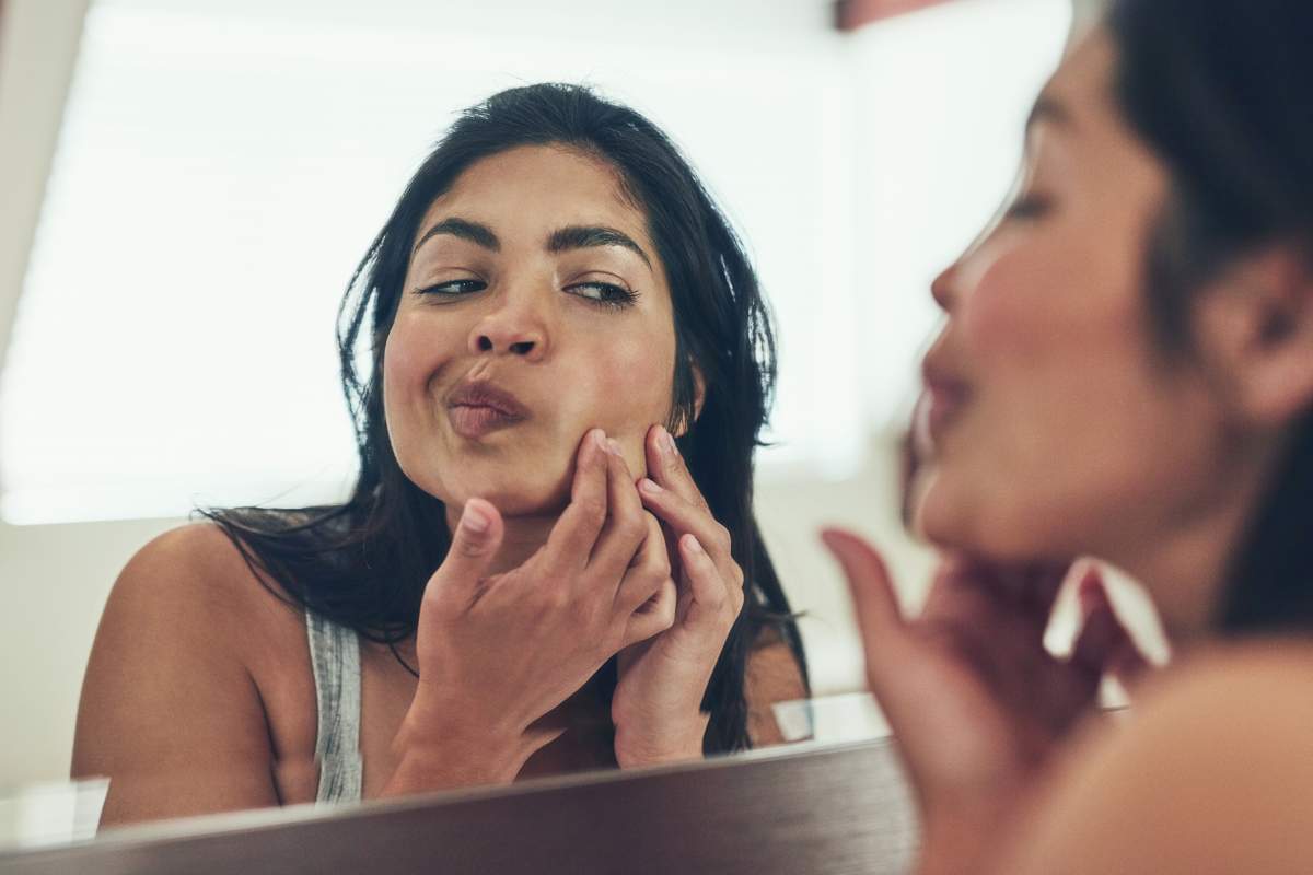 Why some people get more acne in the winter - image