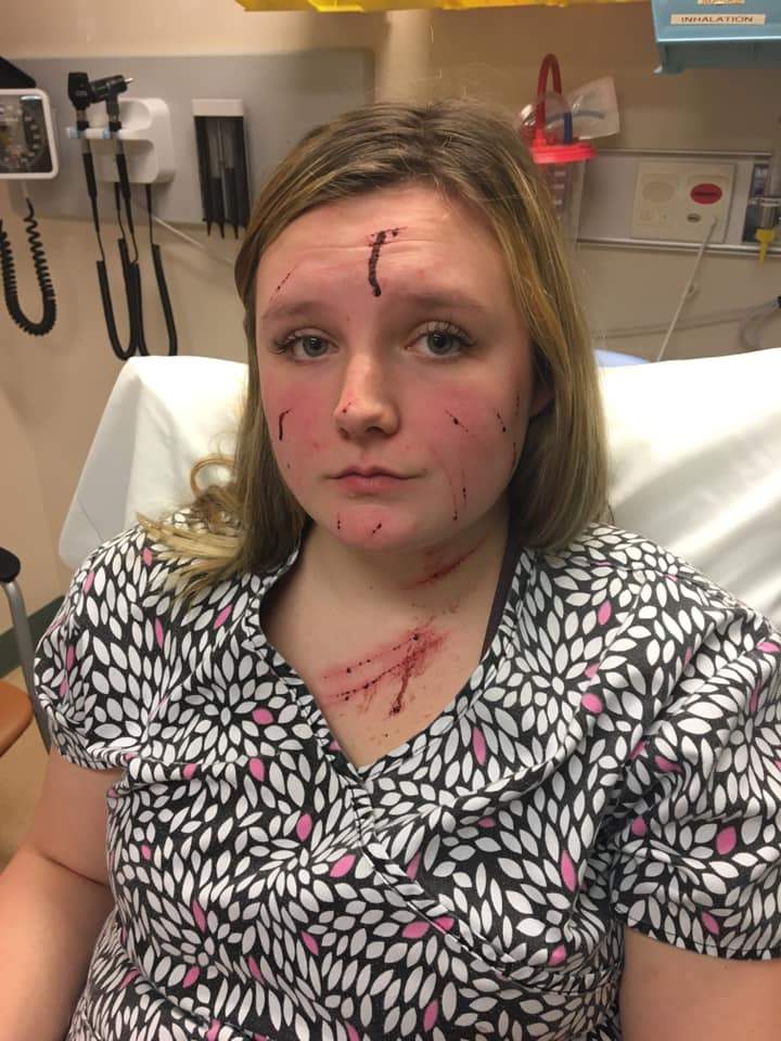 OPP are investigating after a woman was attacked in Bancroft on Monday morning.
