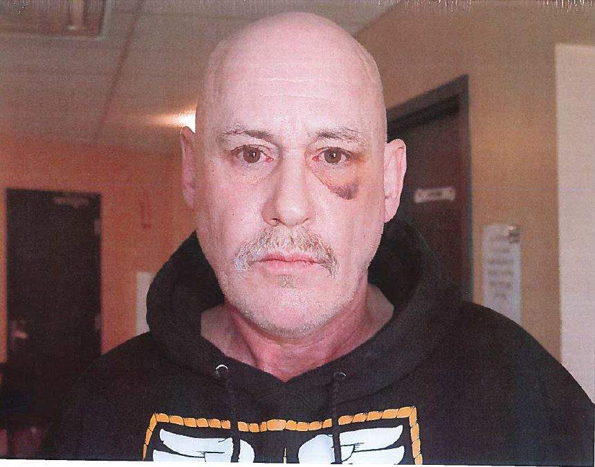 A photo of Patrice Simard after he was allegedly assaulted by police Const. Laurence Gary Basso.