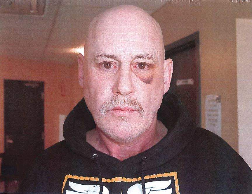 A photo of Patrice Simard taken shortly after his arrest on Feb. 25, 2018, depicts an injury to his left eye. Photo courtesy of the Nova Scotia Serious Incident Response Team