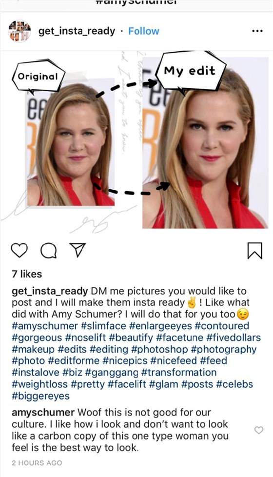 Amy Schumer/Instagram