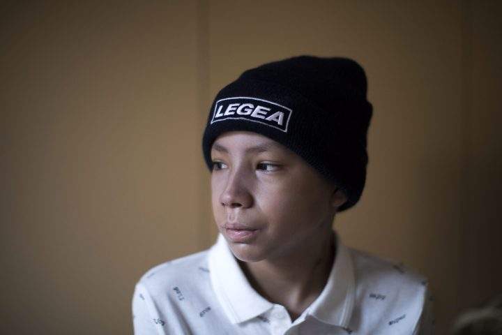 In this Thursday, Feb. 21, photo, 12-year old Jesus Acosta, poses for a photo at a hostel in Barcelona, Spain, where he has come for a bone marrow transplant and follow up care.