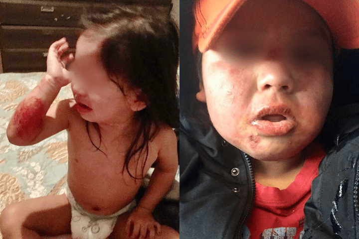 Cat Lake First Nation officials say children are sick after exposure to mould.