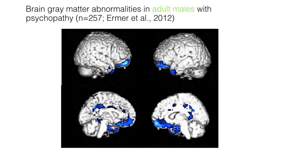 Brain gray matter abnormalities in adult males with psychopathy.