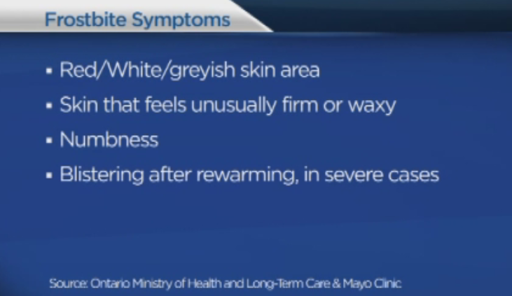 Fourth Frostbite alert issued by Peterborough Public Health - image