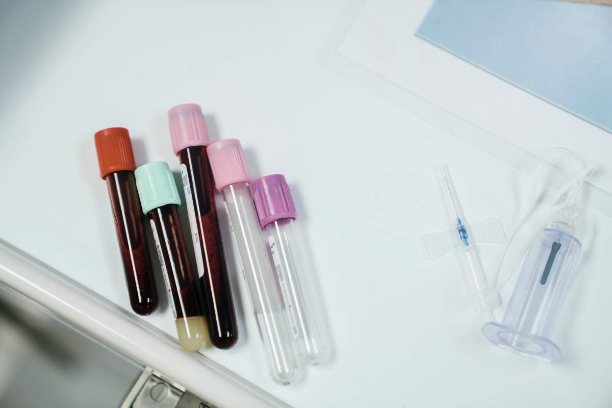 Dynacare said its working to reduce the number of patients waiting outside its Winnipeg diagnostic testing sites.