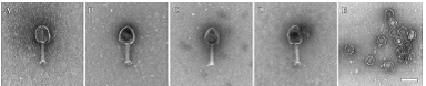 A bacteriophage used to treat a patient with a bacterial superbug infection.