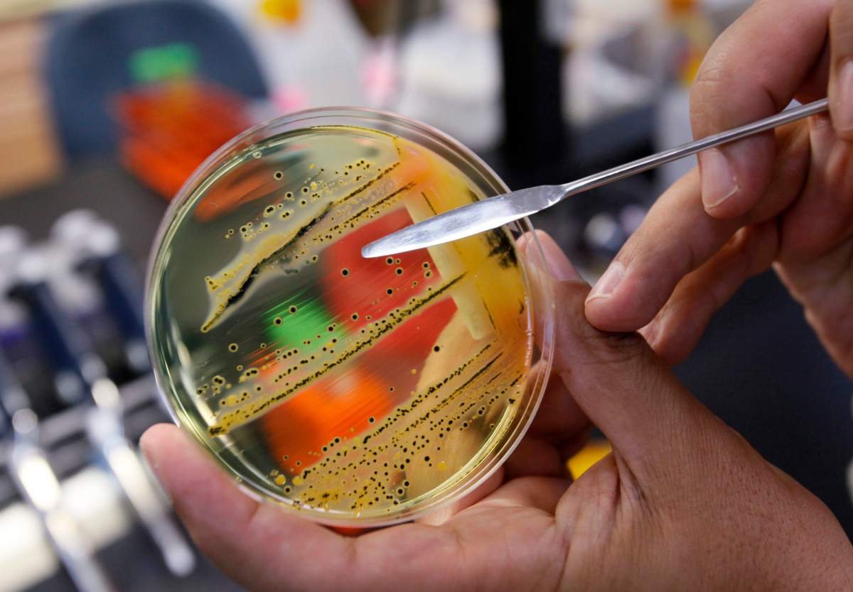 A doctor points out a growth of of salmonella in a petri dish at IEH Laboratories in Lake Forest Park, Wash., in this Monday, May 17, 2010 file photo. 