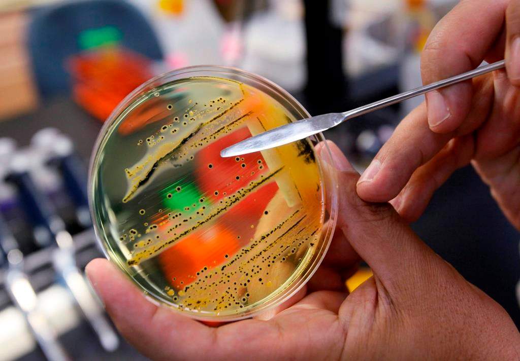 A doctor points out a growth of of salmonella in a petri dish at IEH Laboratories in Lake Forest Park, Wash., in this Monday, May 17, 2010 file photo.