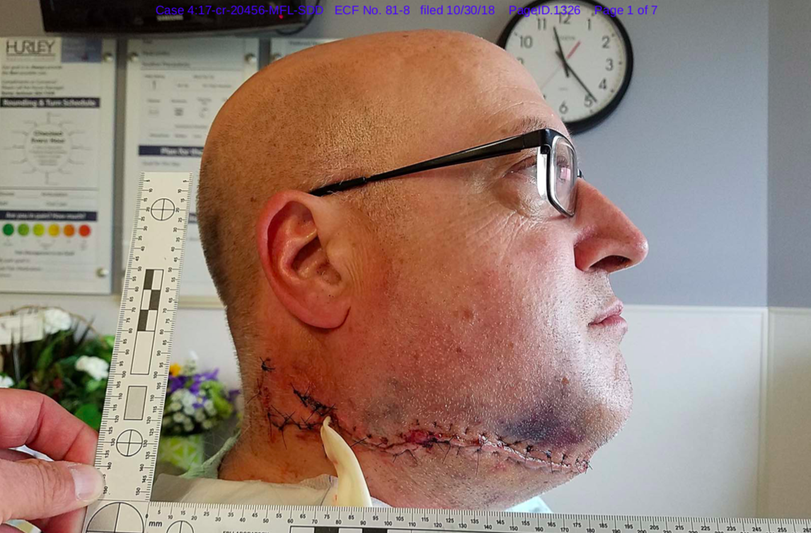 Lt. Jeff Neville, an officer at the Flint, Mich., airport, was wounded when he was attacked by Canadian Amor Ftouhi.
