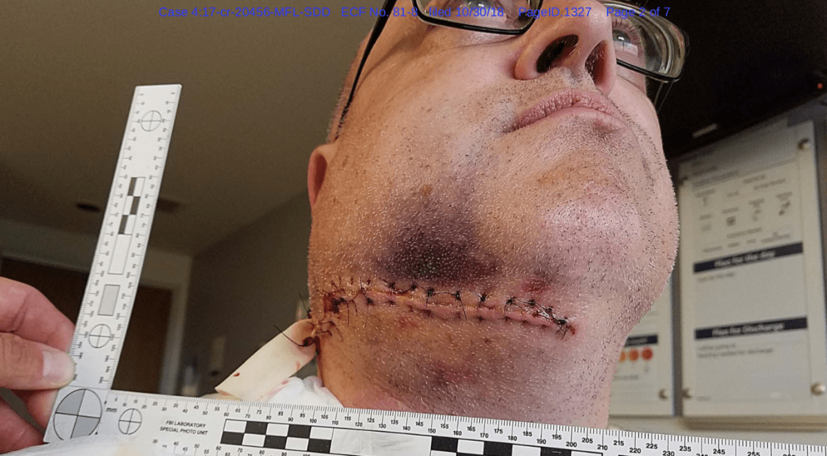 Evidence photo showing stabbing injuries to airport police officer Jeff Neville.