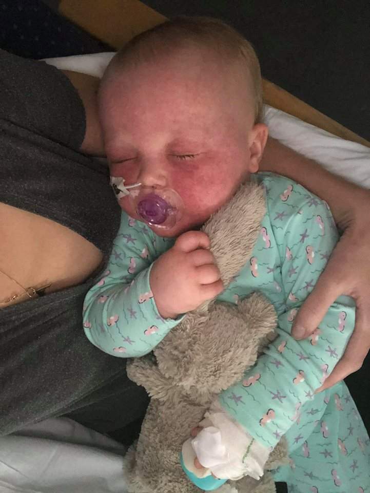 Mom shares ‘horrific’ details of baby’s measles battle - image