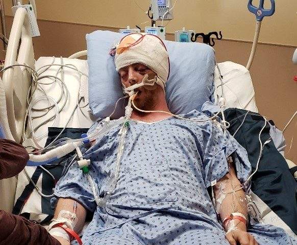 Bradley Eliason is in critical condition at KGH.