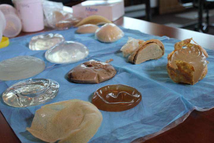 Some of Pierre Blais’ collection of defective breast implants, many of which are no longer in production.