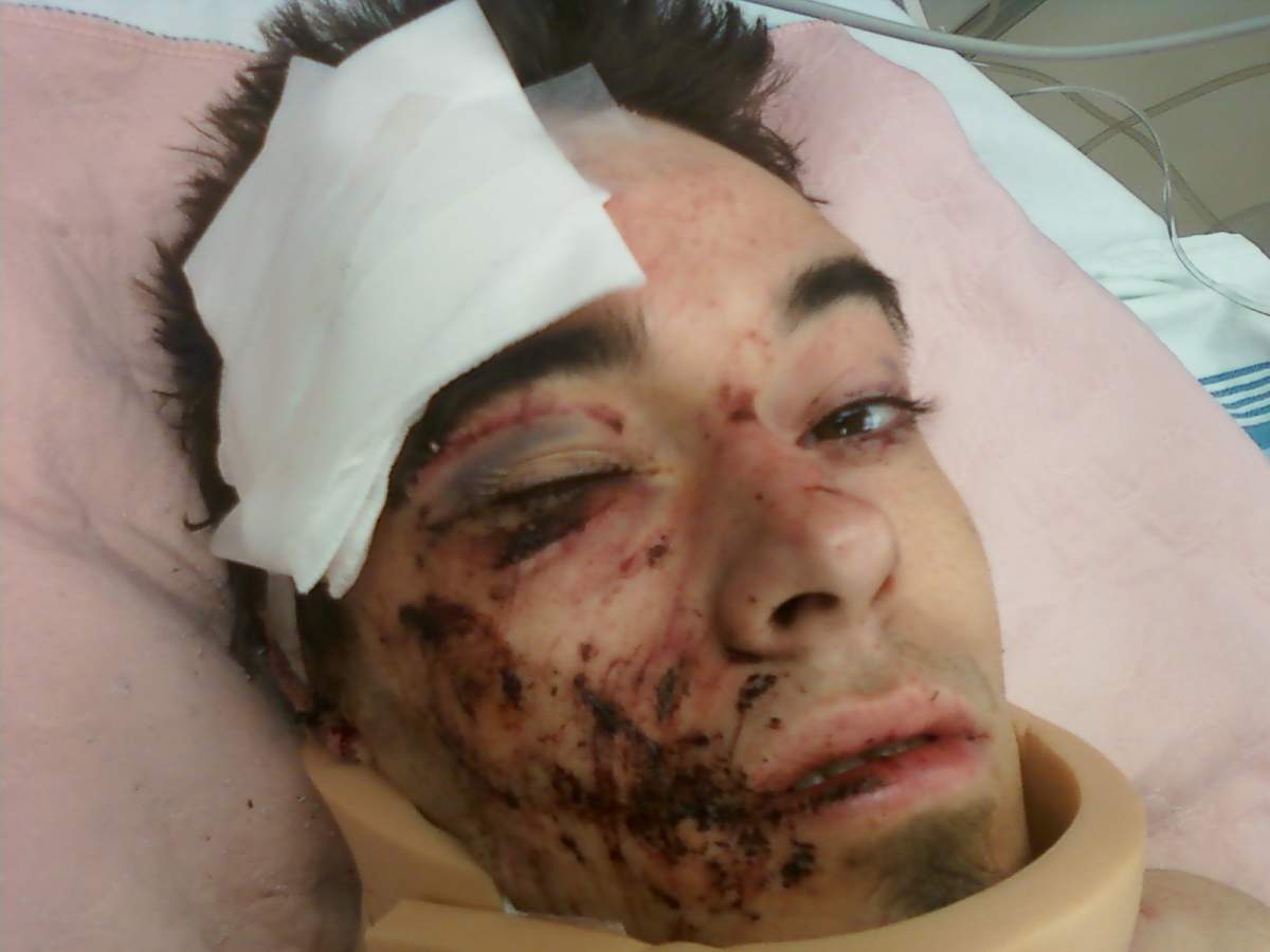 Nolan Barnes life was changed forever when the SUV he was a passenger in with an impaired driver behind the wheel crashed, leaving him a paraplegic.
