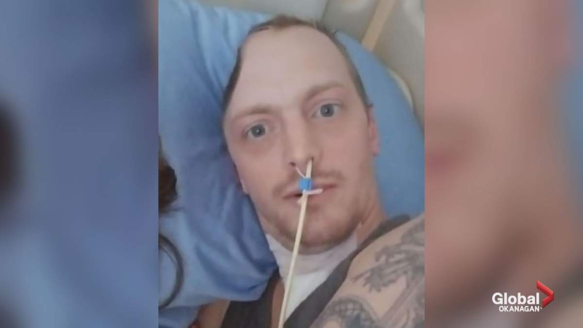 Eliason required 56 stitches to his skull and he was placed in a medically-induced coma because of the swelling on his brain.