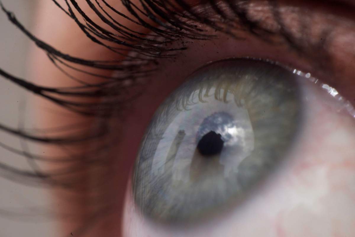 FILE - This April 12, 2018 file photo shows the eye of a woman in New York.   