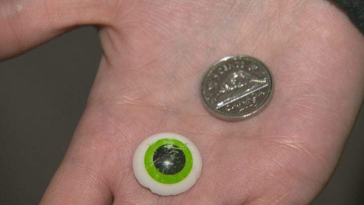 The plastic eye-ball that Hailey swallowed last year.