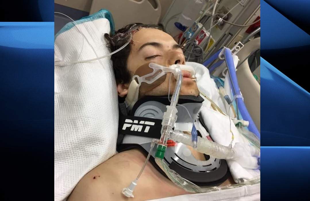 In a post to his Facebook page, Tino Casavecchia writes that instead of his celebrating his 18th birthday, his nephew now has to spend the day suffering from severe brain trauma.