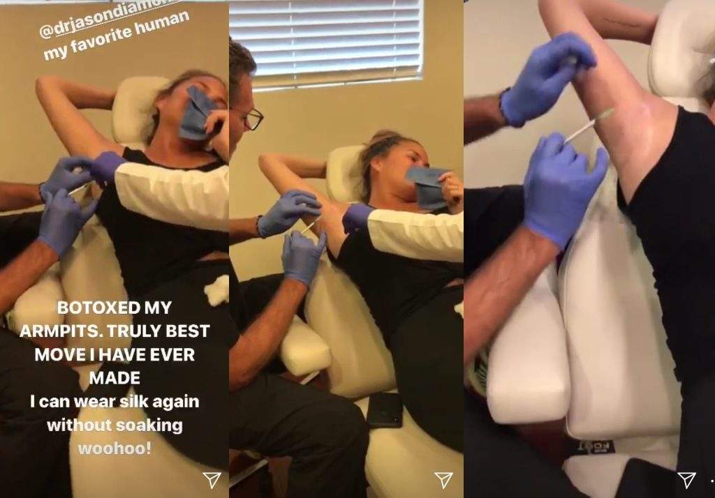 Chrissy Teigen/Instagram