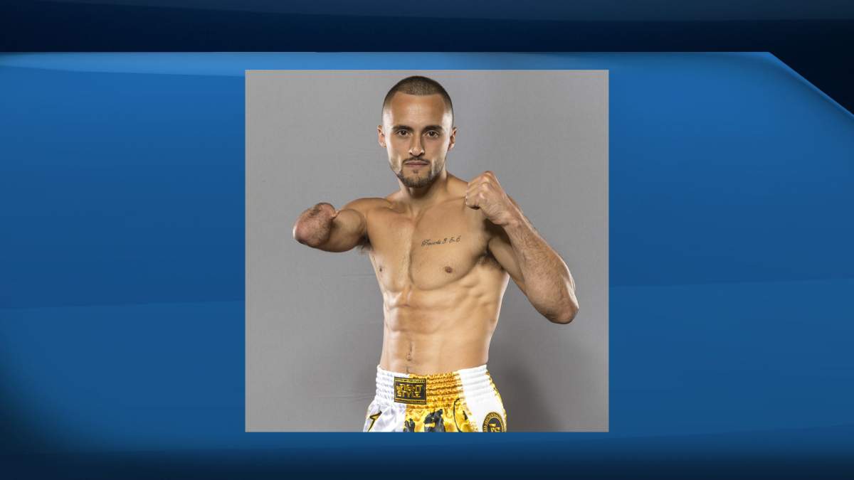 Jake Peacock poses in Las Vegas, Nevada, August 1, 2019. Calgary’s Jake Peacock, a Muay Thai fighter, makes his debut in the Lion Fight promotion in Las Vegas on Saturday against California’s John Garcia. Peacock was born without a right hand or forearm. 