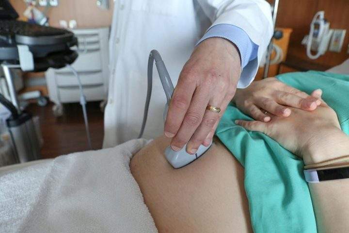 FILE - In this Aug. 7, 2018 file photo, a doctor performs an ultrasound scan on a pregnant woman at a hospital in Chicago. (AP Photo/Teresa Crawford, File).
