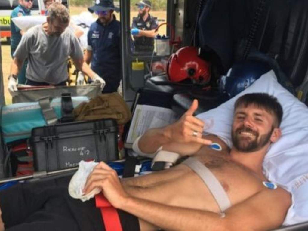 Danny Maggs gave the camera a thumbs up while being treated for a shark-attack wound.