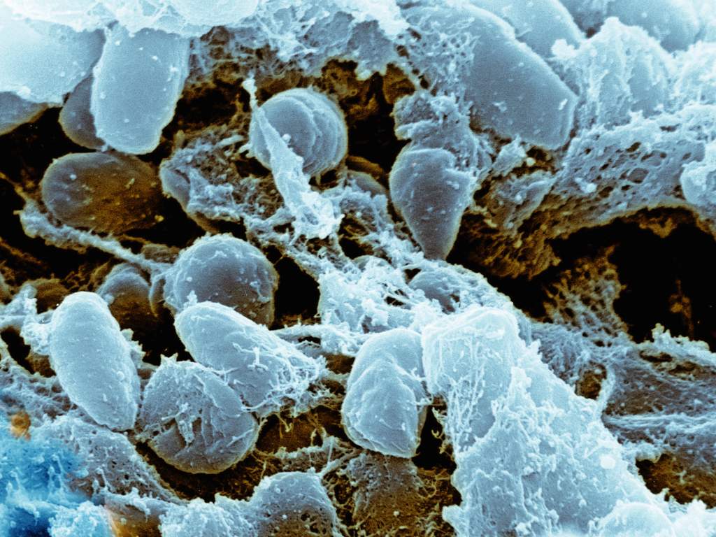 plague bacteria