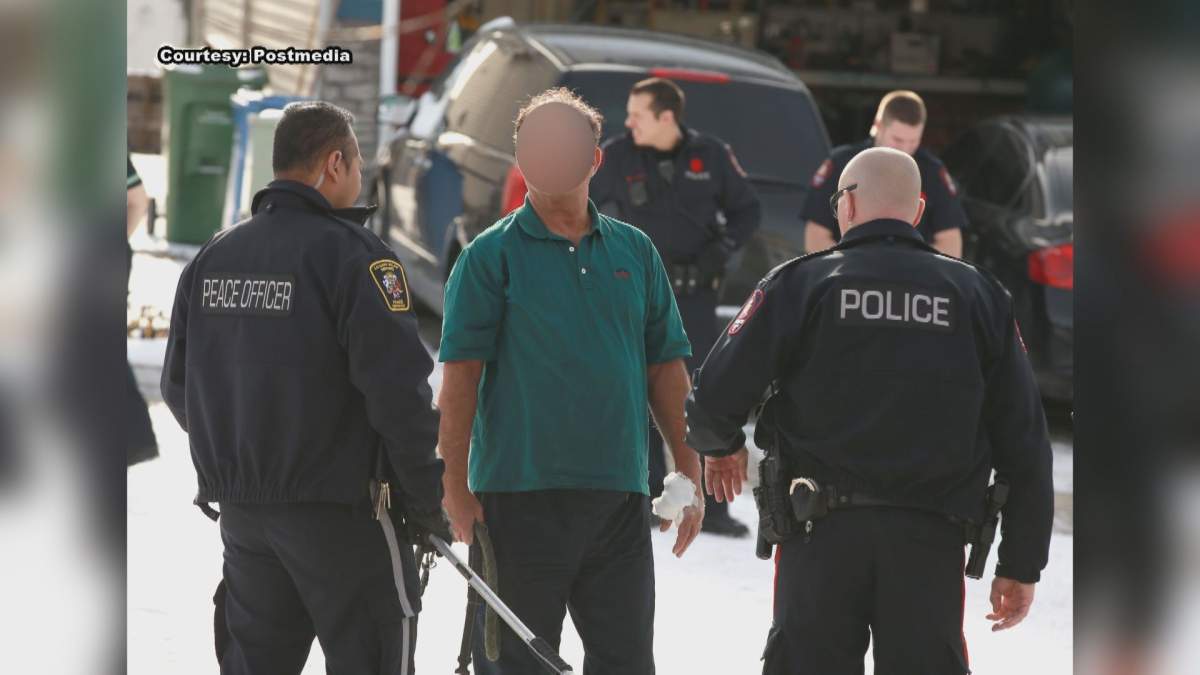 A man with injuries is seen after a dog reportedly attacked three people in Calgary.