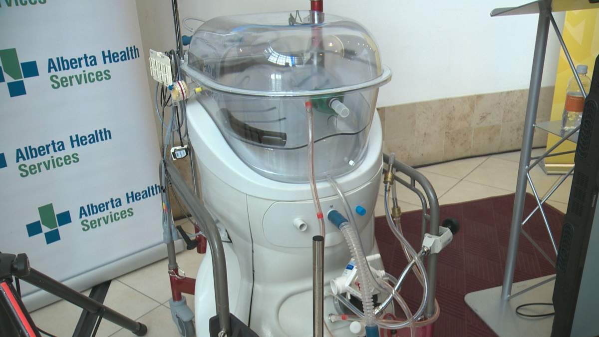 The Alberta-developed Ex-Vivo Organ Support System (EVOSS).