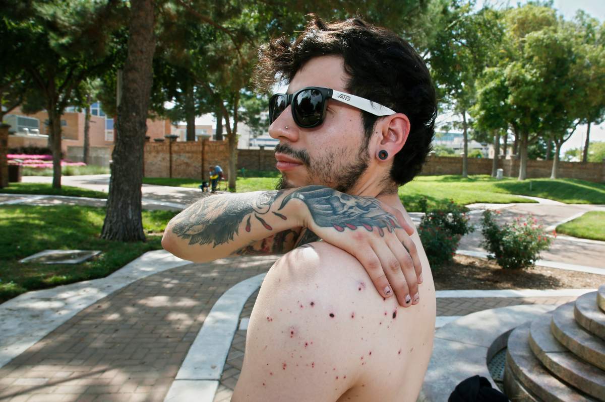 Daniel Munoz reaches for his injured back during an interview, Sunday, Sept. 1, 2019, in Odessa, Texas.