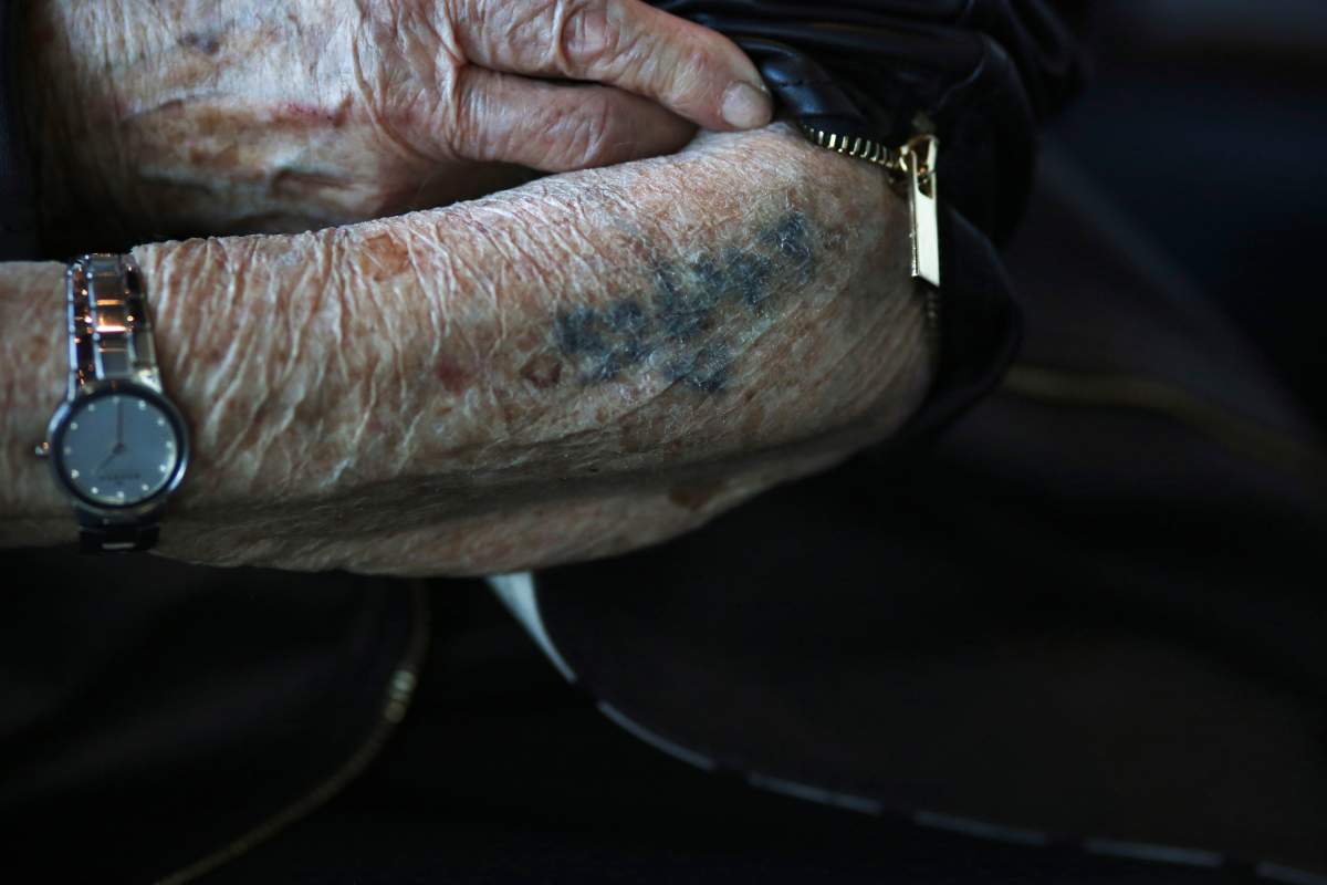 In this Jan. 22, 2020, photo, Holocaust survivor Bronia Brandman roles up her jacket sleeve at the Museum of Jewish Heritage in New York to reveal the numbers 52643, which were tattooed on her arm at the age of 12 upon her arrival to the Auschwitz concentration camp.  (AP Photo/Jessie Wardarski)