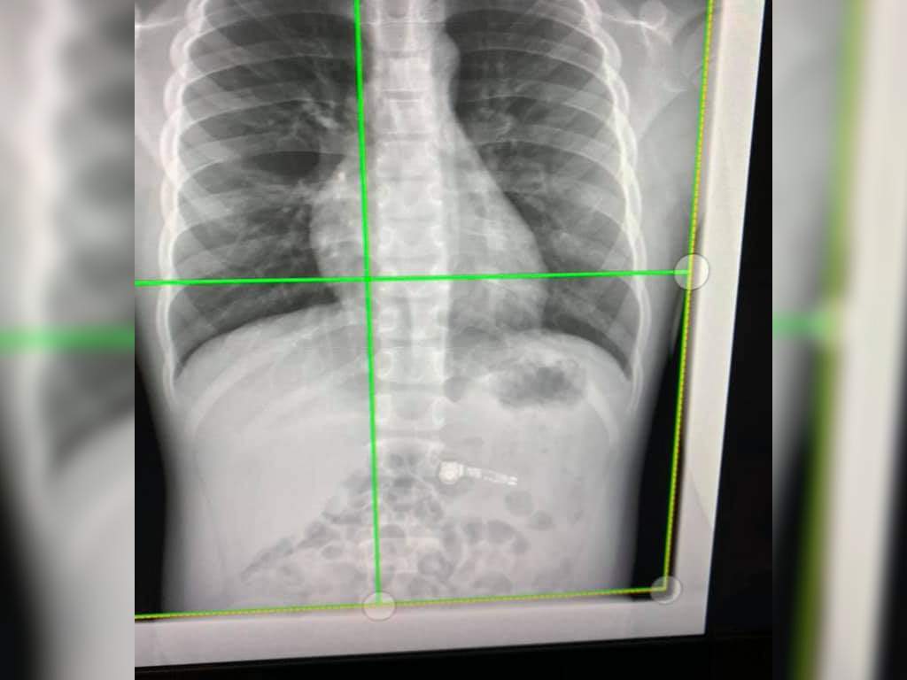 Kiara Stroud's son was rushed to the hospital after accidentally swallowing his AirPod.