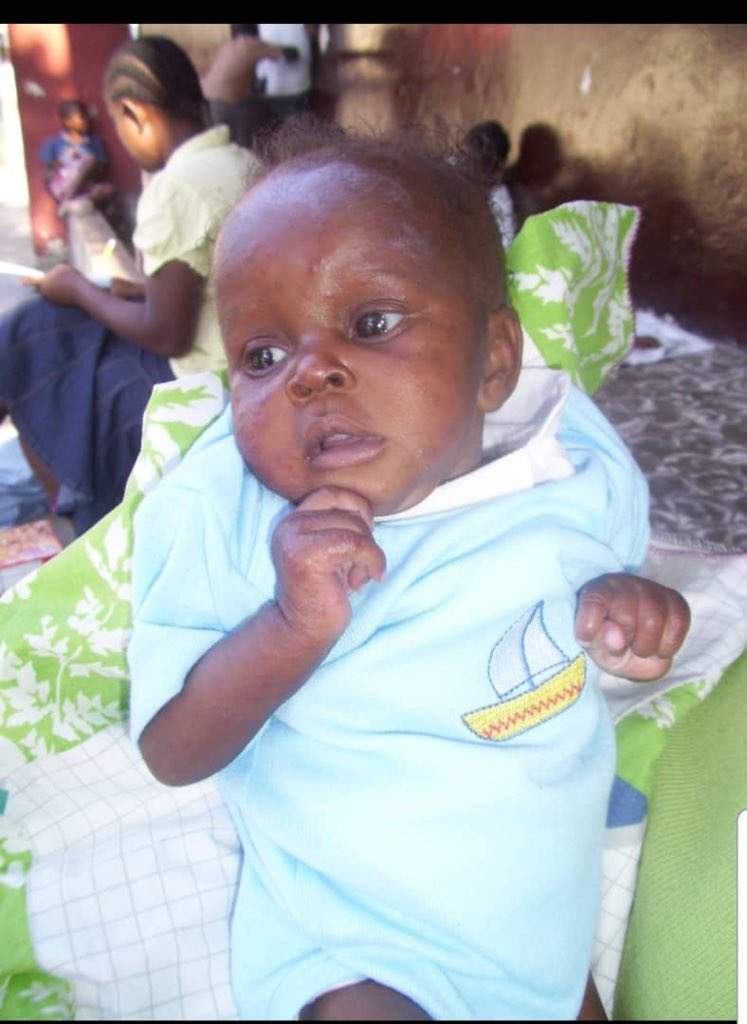 Kettelie when she arrived at Hope Home in 2010.
