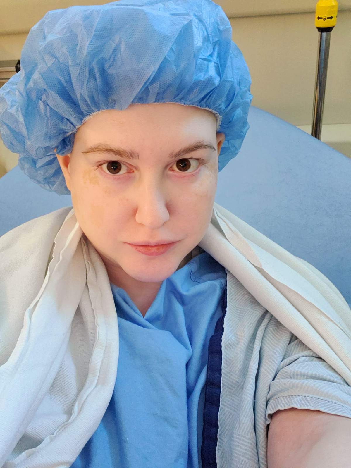 Wilson during treatment.