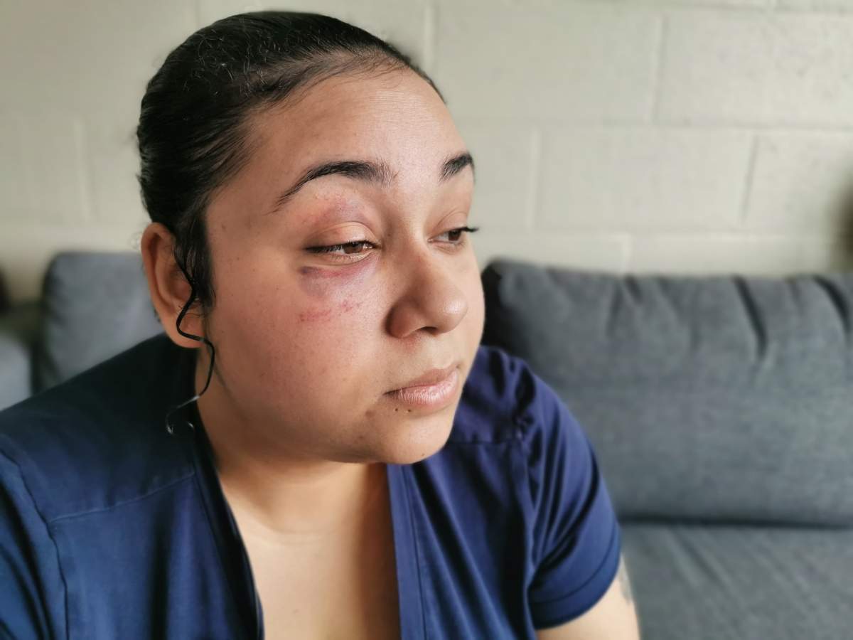 Santina Rao injuries